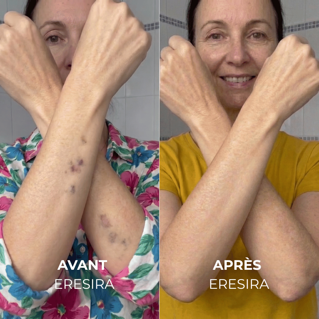 ERESIRA - Sérum derma elixir